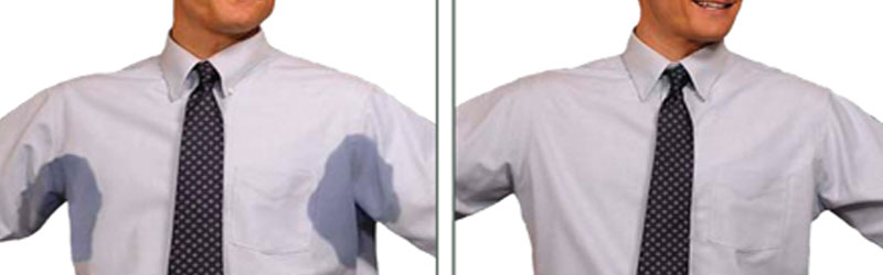 Excessive Sweating